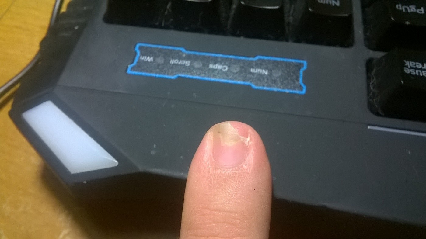 Cutting My Warped Pinky Nail