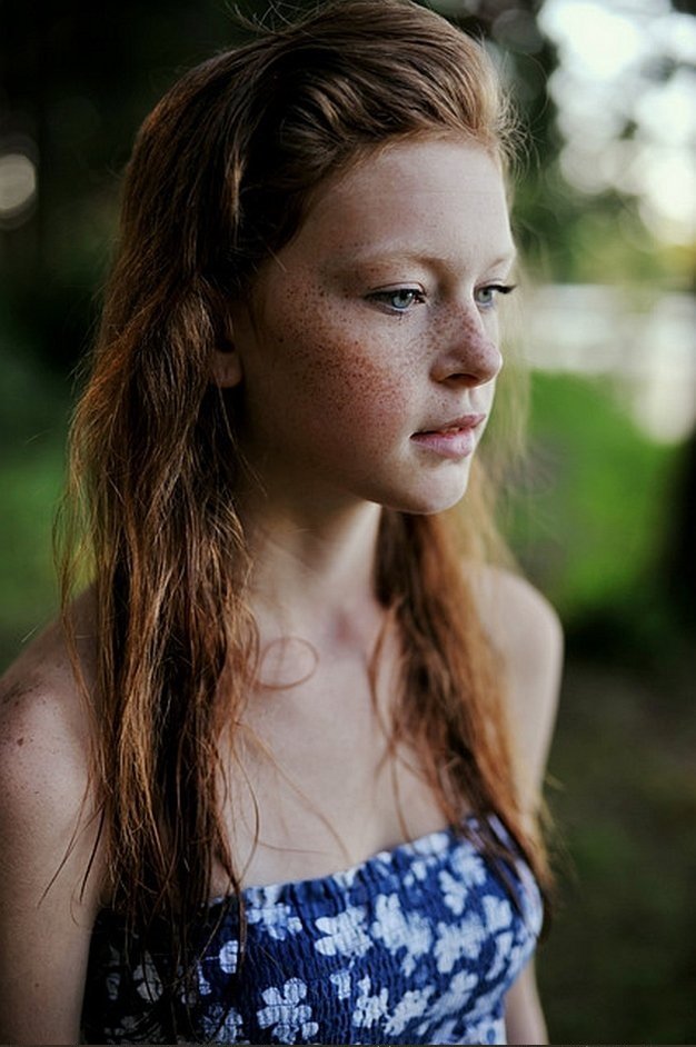 Jb Teen Girls With Freckles